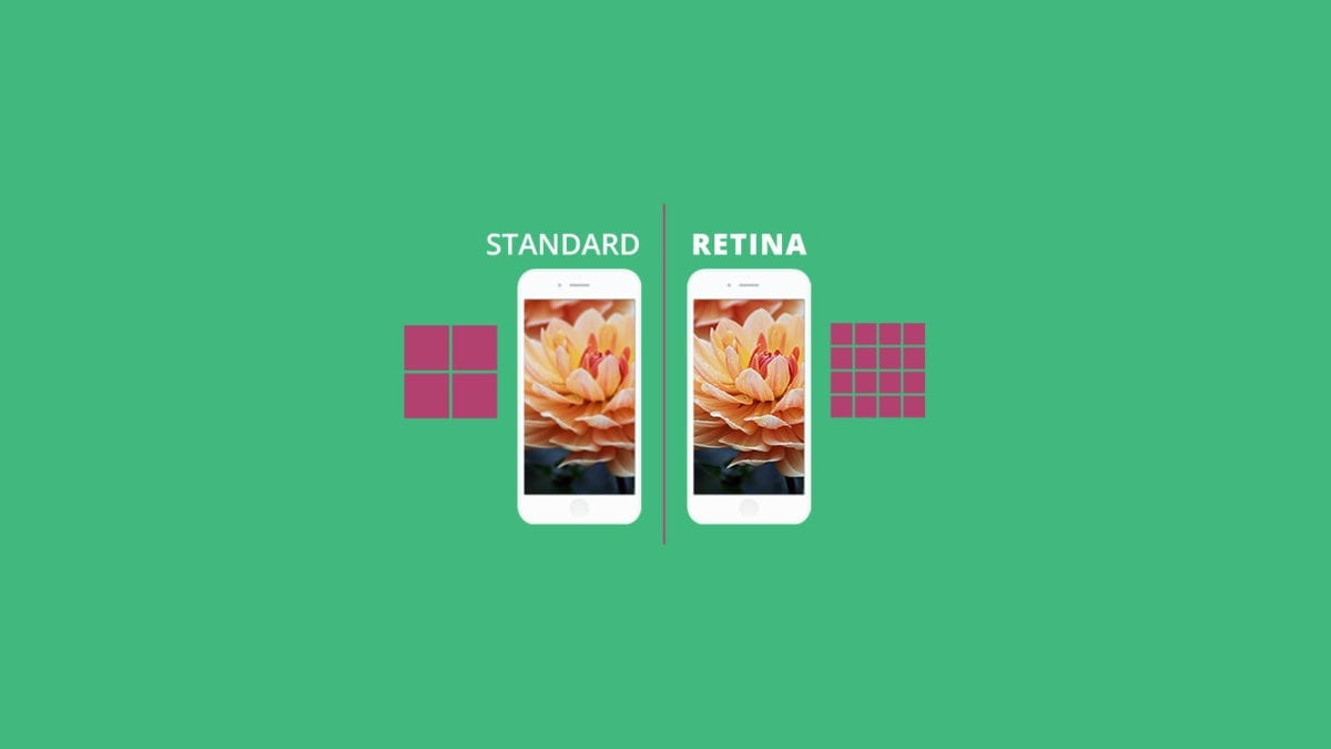 Retina Images